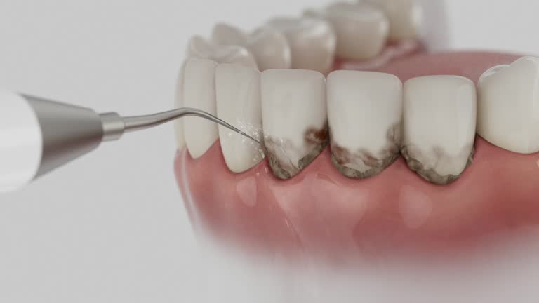 Trusted Invisalign Clear Aligners service in Florham Park, NJ - Dentist Open Now